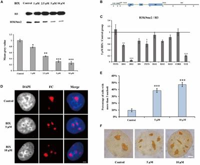 H3K9 Demethylation-Induced R-Loop Accumulation Is Linked to Disorganized Nucleoli